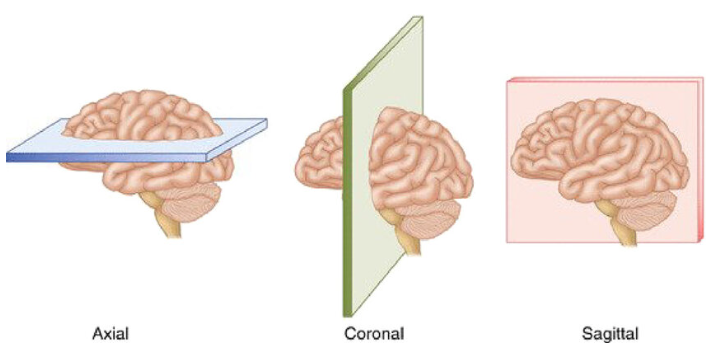 MRI brain planes